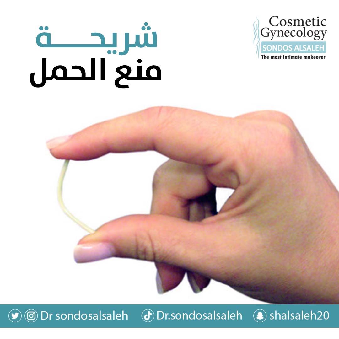 شريحة منع الحمل!
هي إحدى الطرق الحديثة والفعالة لمنع الحمل بواسطة شريحة بلاستيكية والتي تطلق هرمون البروجستيرون بشكل يومي بكمية منخفضة وثابتة وتصل فعاليتها الى ٣ سنوات ✅

للحجز والاستفسار بي من خلال التواصل على: 
📌 
0565303110
0138555546