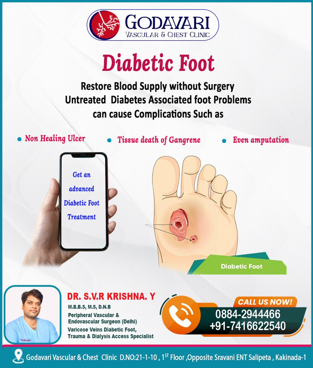 Diabetic Foot  restores blood supply without surgery 
For appointment :0884-2944466,+91 -7416622540
#diabeticfootcare #diabetictreatment #besthospitalinkakinda
#bestvascularsurgeon #godavarivascular #NonHealingUlcers
#amputation #Gangrene #diabeticfootcomplications