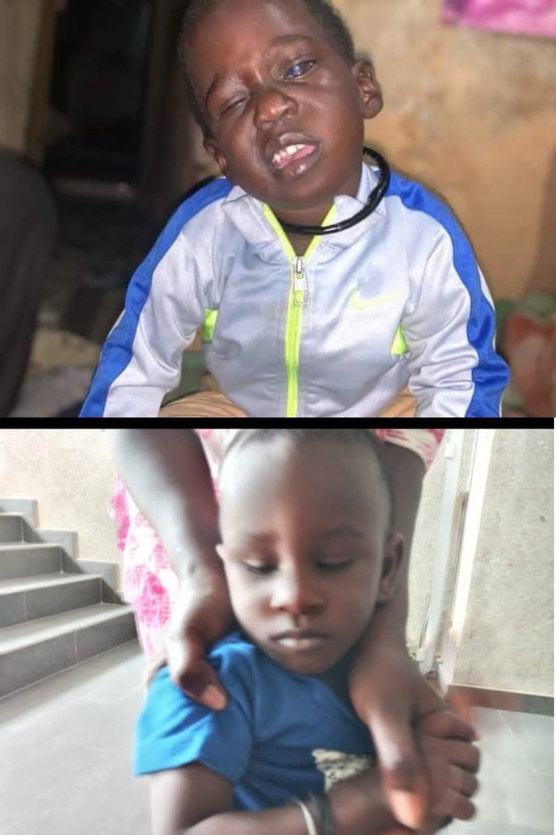 Makhfouss2's tweet photo. URGENT🚨 

Saliou et Amadou risquent de devenir aveugles s’ils ne sont pas opérés rapidement. Leurs 2 mamans (qui n’ont aucun lien de parenté) sont toutes les deux muettes et vivent dans des condition

Orange Money/Wave: 77 795 27 42

Somme collecté :  8.037.000 F
Objectif : 12M https://t.co/AU9KZYoh7Z