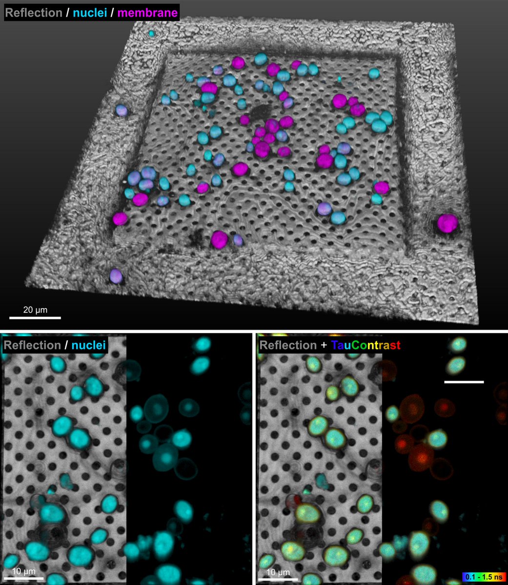 What if… you can take advantage of using instantly fluorescence arrival time information under cryogenic conditions? Well, you can acquire very insightful image data and potentially discover more specific results even below ~ -200°C.