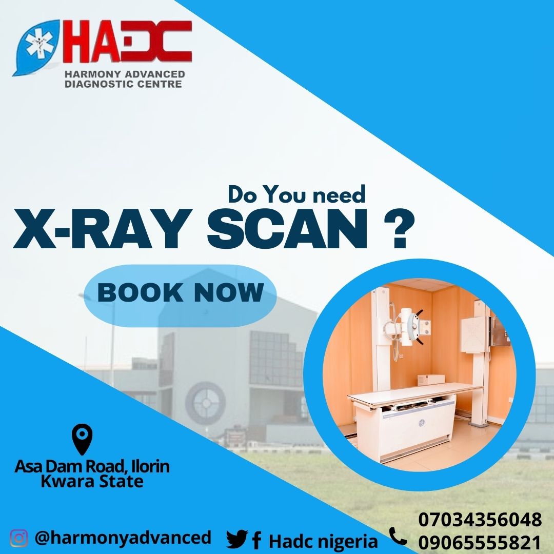 HadcNigeria's tweet photo. Ready to serve you better.
#newweek #mondayrush #medicallab #xrayilorin https://t.co/OpezMonz3L