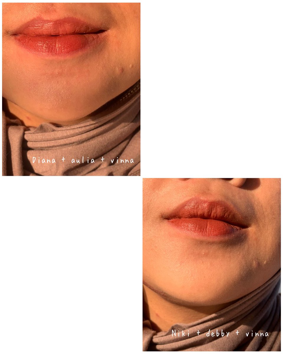 prismakhansa's tweet photo. Emang boleh se-ombre ini?

Aku lagi racik2 lip ombre yang menurut aku cucmey dan bisa kamu cobain sendiri kalo ada shadesnyaa!😍🤍 https://t.co/G7qAOF6I82