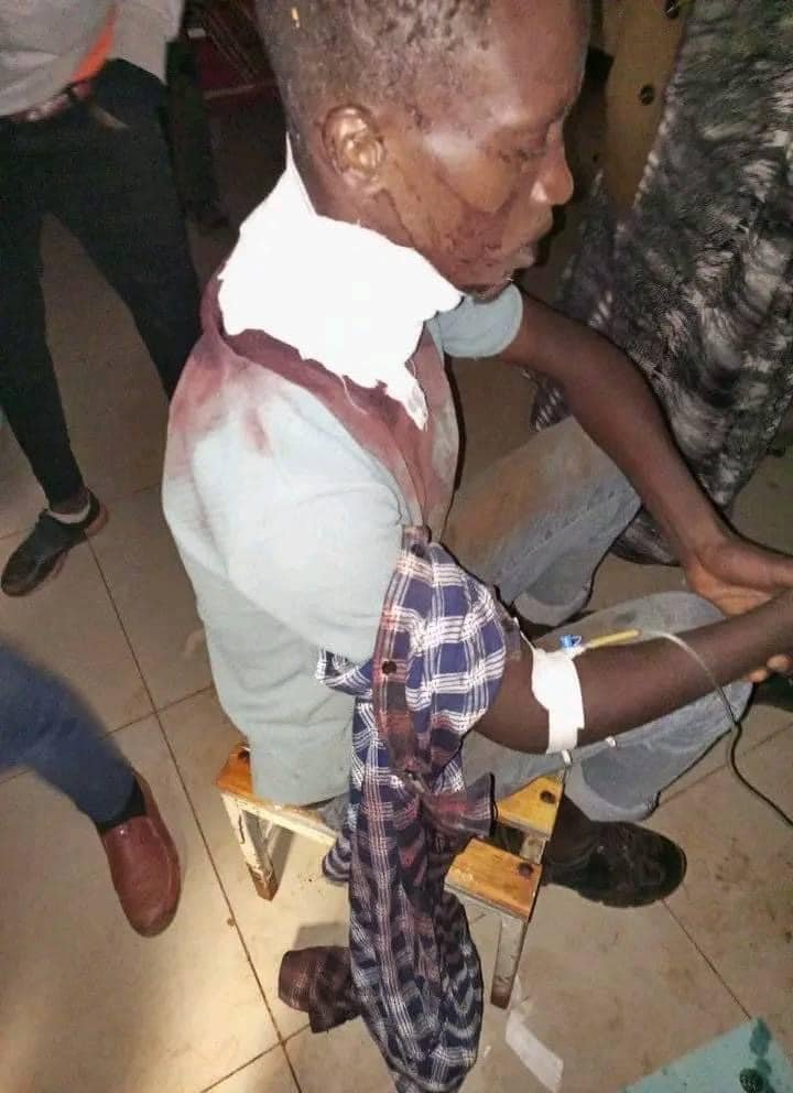 ollaaOromo's tweet photo. A university student by the name Gannaalee Kureessaa allegedly shot multiple times on the neck by Ethiopian military personnel in East Guji Zone.
#HumanRights 
#StopWarInEthiopia
#OromosRight2Life 
#Ethiopia 
#Peace https://t.co/jzuyGTLSK6