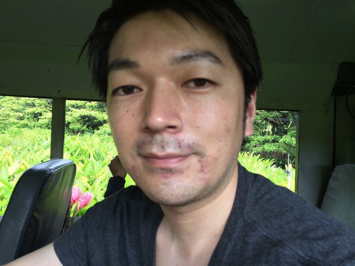 st_r0817's tweet photo. 40代バツイチ男性が若返りに成功し、5年彼女なし→たった1ヶ月で″人生史上最高の彼女″を獲得した外見追求の裏技を公開。

【人は何歳からでも変われる】
これは完全に嘘。

理由として、
・エネルギー不足
・外見が圧倒的に老ける
・誰も指摘してくれなくなる
・ジェネレーションギャップ
・年齢で女性から損切りされる
・思考が凝り固まり頑固になる
・習慣として身につくのが遅くなる

出会うのが1日でも遅れたら今の結果はない。

▽Beforeの改善点

・青髭
・肌荒れ
・ボサボサ眉
・顔のむくみ
・髪が短すぎ
・年相応の見た目
・大学生っぽい服装
・どこか頼りない感じ
・ノンバーバルの弱さ

▽やったこと

・髭脱毛
・髪型改善
・一流美容室
・眉毛サロン
・スキンケア改善
・ヘアセット練習
・ナチュラルメイク
・ファッション改善
・ライフスタイル改善
・ブランディング習得
・コミュニケーション指導
・仲間やライバルがいる環境

━━━━━━━━━━━━━━
外見追求の��細
━━━━━━━━━━━━━━

①ファッション

40代170cm前半の彼は、

・清潔感
・色気を活かす
・モデルスタイル
・大人の余裕感を出す

ここをテーマに以下のスタイリングを組んだ。

彼の改善点でもあるどこか頼りない感じは、フォーマルスタイルで解決できる。

▽ styling item

shirt：suitselect
bottom：UNIQLO レディーススキニー
shoes：endevice ヒールブーツ
ring：Cartier
bracelet：HERMES シェーヌ
necklace：Swarovski Attract ネックレス

シンプルだが洗練されている。

40代以降は、

変に若返りを狙って韓国系にするよりも、こういうフォーマルスタイルで”イケオジ路線”の方がハマる。

シェーヌダンクル(ブレスレット)のような1点ゴツメなアクセサリーを入れるとフォーマル過ぎず、少し崩れお洒落さも加わる。

反響あれば、

最近見つけて感動した”1万円以下の神アクサセリー集”を公開しようと思う。

------

②ヘア

彼のどこか頼りない印象は”丸顔”も1つの要因だ。

顔の縦幅に対し横幅が長い印象を与える丸顔は幼く、優しそうに見えがち。

そこを解決する為に
”センターパート×パーマ”を選定。

(スタイリングは艶系ワックスを)

センターパートの印象は、

・大人っぽさ
・爽やかさ

そこにパーマ当てることで、

・セクシーさ
・お洒落感
・チャラさ
・上品さ

が加わり若者にはない大人の色気を得る。

因みにパーマスタイルは、

スタイリング時間を短縮したい
スタイリング技術に自信がない

こういった人にマジでお勧め。

最近のパーマ技術では、下手に毎日アイロンを当てるよりもダメージを抑えられる。

------

③肌

彼の肌の改善点���して挙げられるのが

1.ニキビ
2.加齢によるシワ

1. ニキビ

まず1番に口周りの肌荒れが目立つので”髭脱毛”を提案。

また肌タイプをチェックし、スキンケアも手順を1から見直しアイテムまで選定。

美肌ケアを重点的に行い、驚くべき若返りに成功した。

※肌タイプを理解しないでスキンケアを選んでいる人が多いが本当に危険。

ALBIONなら無料で5分で診断してもらえるから絶対に行ってくれ。

2. 加齢によるシワ

スキンケアで改善された部分はあるが、他はメイクでカバー。

特に、

”Clé de Peau Beauté ヴォワールコレクチュールn”1つで本当に若返った。

(私も使用している)

メイクはナチュラルが最も女性ウケが良いので覚えておこう。

下地
↓
ファンデーション
↓
アイブロウ
↓
パウダー
↓
リップ

モテたいなら必須。

-----

④美容施術

結論、女性にモテたいなら

・髭脱毛
・眉毛サロン
・ホワイトニング

これ以外はやらなくて良い。

まずコンサルではここを初めに指導する。

因みにオススメは、

髭脱毛
→TOKUNAKAクリニック

眉毛サロン
→TOKYO BABE

ホワイトニング
→中野坂上アクロスシティ歯科

他の専属の方も皆んな行っている。

-----

⑤仲間やライバルがいる環境

結局、環境を変えたから外見が良くなったと言っても過言ではない。

自分の周囲の友達が

・超カッコ良い
・超モテてる
・超お洒落

だったら、
自分も自ずとそのようになる。

この言葉は知っているだろうか？

You are the average of the five People you spend the most time with.

- あなたは、最も一緒に過ごす時間の長い5人の友達の平均になる。

シンプルだが真理。

(���みに”年収”に関してはアメリカの研究で証明されている)

だから本気変わりたいなら環境を変えること。

楽しながら、成功できるほど甘くない。

-------

40代の男性でも驚くべき変貌を遂げた。

また他にも、

・ノンバーバル
・コミュニケーション

ここを徹底的に指導したけど、反響あればここら辺も公開していこうと思う。

━━━━━━━━━━━━━━
コンサル生の感想
━━━━━━━━━━━━━━

amiさんお疲れ様です！
いつも撮影やご指導ありがとうございます！

amiさんとはTakuroさんのご紹介でお会いすることができました。

それまではバツイチとなった後、男としても人としても自信が持てないまま何年も過ごしていました。

当然ながら女性関係も自分の思う様な状況にはならず、
年齢的にも取り返しつかないよな、このまま一生過ごしていくのかな、
それはイヤだけどどうしたらいいのかな、などと考えていました。

今では女性関係に困ることもなく、外見も全く前の自分と異なります。

自分にとって最高の女性とお付き合いする事ができているだけでなく、
尊敬できる恩師（amiさん）、自分を向上させていける環境、切磋琢磨できる仲間にも
恵まれて充実した毎日を送っています！

指導内容は全てためになるものですが、特に強く印象に残っているのは２つ。

外見は重要であり磨いていくのは当然。その上でのコミュニケーション能力がとても大事だという事。
これが全てにおいての基本なのだな、と改めて痛感している所です。

20代とか早くからこれを理解していれば…と思い返した場面は何度もありました。
女性関係だけでなく、仕事、��人、家族など全ての人間関係がより充実していきます。

もう一つは指導者が本気である事。
本当にこちらの事を良くしようとしてくれている事が日々のやり取りで伝わってきました。
そしてそれは尊敬、信頼となり「自分もこの人みたいになりたい」と思わせてくれる
のに十分なものでした。それはもちろん今も続いています！

もし「自分も変わりたいけど、どうしたら…」と悩んでたり、
私のビフォーアフターを見て「自分も変われるんじゃないか」と思ったら、
迷わずamiさんに会ってみる事をオススメします！

少しでも気になってるのに行動せずにいたら絶対後悔します。

自分ももっともっとカッコよくなるため、自分の人生を充実させていくため
頑張っていきますので、引き続きご指導よろしくお願いします！

━━━━━━━━���━━━━━
終わりに
━━━━━━━━━━━━━━

「モテることを諦めたくない」

こう言って彼は私のところに来てくれた。

だから、私も全力で応えた。

外見は誰でも変われる。

必要なのは”覚悟”と”正しい知識”のみ。

これを見てくれている人も諦めないで欲しい。

惰性で毎日を過ごせないで欲しい。

自分自身で限界を決めないで欲しい。

外見を磨けば、素晴らしい未来が絶対に待っている。

私も外見を磨いたから、こうやって発信できている。

もちろん、全ては皆んなのおかげだ。

だから、今回も

・RT,いいね
・リプに「👕」

を送って応援して欲しい。

・10人中9人YESと言うコーデテンプレ
・40代が1ヶ月で彼女を作った方法

反響あれば公開する。

ここまで見てくれて本当にありがとう。