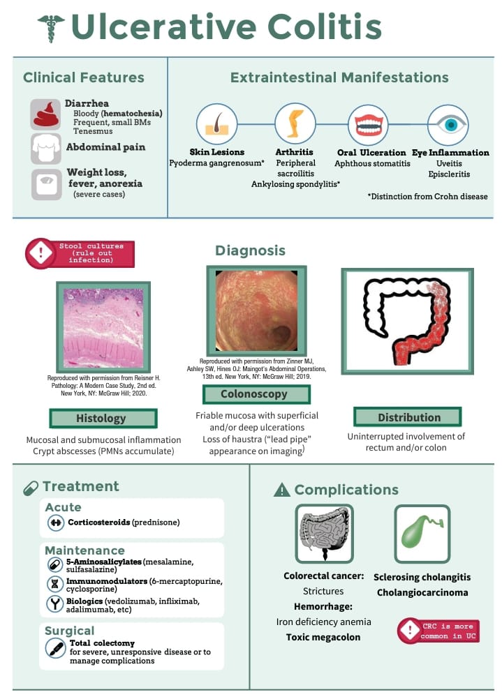 pgMedicine's tweet photo. IBD
Crohn's disease 
Vs 
Ulcerative Colitis 

For regular uploads of valuable medical videos
Subscribe 👇
https://t.co/eo0l4HoS9t https://t.co/ZUoy9LomTL
