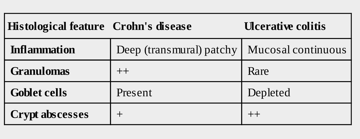 pgMedicine's tweet photo. IBD
Crohn's disease 
Vs 
Ulcerative Colitis 

For regular uploads of valuable medical videos
Subscribe 👇
https://t.co/eo0l4HoS9t https://t.co/ZUoy9LomTL