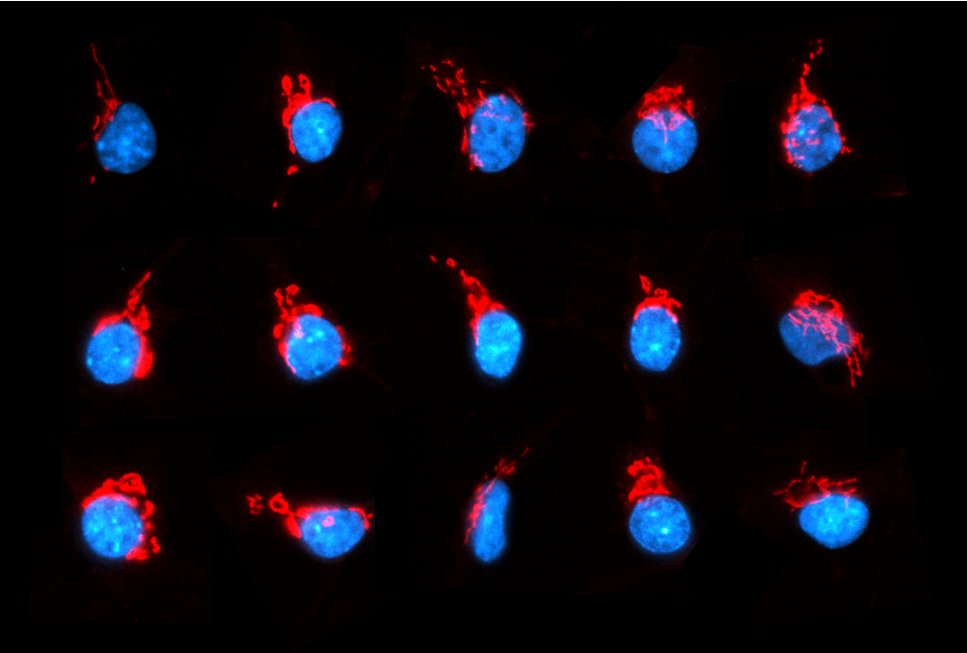 Encephalon2023's tweet photo. #MicroscopyMonday: Meet our #encephalon2023 organization team! Whether we indeed look like these nuclei (cyan) and their associated Golgi (GM130, red), you can check on our website: https://t.co/AOuFjmlzxn or on 7th December at the @mpi_nat! #goettingen #conference #neuroscience https://t.co/J16v5N3ajC