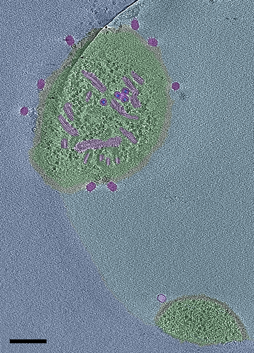 NEMI (@projectnemi) on Twitter photo Phages infecting protoplasts Bacteriophages phi29 attaching, infecting & replicating in Bacillus subtilis protoplasts by Véronique Ongenae (<a href="/VeroniqueO5/">Véronique</a>), <a href="/UniLeiden/">Universiteit Leiden</a>
🔬Titan Krios transmission electron microscope (#TEM), Netherlands Center for Electron Nanoscopy (NeCEN), Leiden Phages infecting protoplasts Bacteriophages phi29 attaching, infecting & replicating in Bacillus subtilis protoplasts by Véronique Ongenae (<a href="/VeroniqueO5/">Véronique</a>), <a href="/UniLeiden/">Universiteit Leiden</a>
🔬Titan Krios transmission electron microscope (#TEM), Netherlands Center for Electron Nanoscopy (NeCEN), Leiden