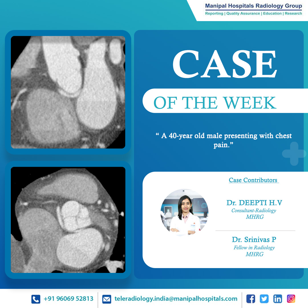 ManipalMhrg's tweet photo. Presenting our #CaseOfTheWeek -  A 40-year-old male presenting with chest pain.

Know more: https://t.co/6dBAIrVEzj

#radiologyy #teleradiology #MHRG https://t.co/ipsIFCirzz