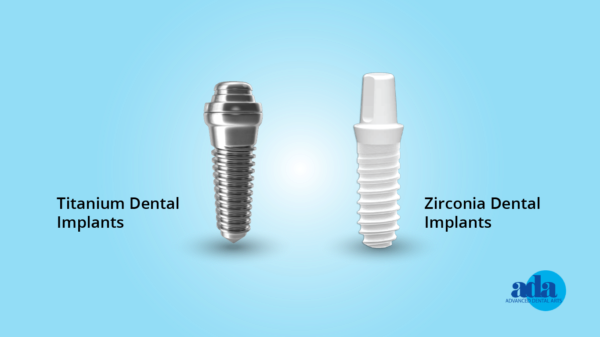 theNOBSdentist's tweet photo. Dental implants are viewed as our bionic escape from the woes of cavities.

“My teeth are jacked, I’ll just get implants eventually”

Implants have come a long way and a great *last resort* option for when a tooth must be extracted. 

Today I’m going to explain it all.

A few things before we start:
1) This is going to be LONG
2) Every patient has different needs, this post may or may not apply to you
3) I place and restore basic implants (not complex cases)
4) I will be fielding questions from my last tweet throughout this post
5) At the time of writing this intro, I have no idea how this will turn out since this is such a large topic with many textbooks dedicated to the subject (pray4me)

Let’s begin:

*What is a dental implant?*

I’m going to be blunt: A dental implant is a goddamn screw in your skull, typically made from titanium. It serves as a foundation for a replacement tooth or a dental bridge. The implant fuses with the bone in a process known as osseointegration, providing stable support for the artificial tooth. Then you put a tooth shaped crown (typically made of ceramic) on top of that screw. Now you have a complete dental implant. There are a few components to the implant:

the implant (the post or screw)
The abutment (this connects the screw to the visible tooth)
The crown (this is the white thing that looks like a tooth but its made of ceramic

*How does an implant stay in?*

An implant stays in place through osseointegration, where the implant fuses with the jawbone over time. Osseointegration is a good thing, but this does not make it a tooth. It’s not a dynamic part of your body like a tooth is. This secure attachment to the bone ensures the stability and durability of the implant, allowing it to function much like a natural tooth root.

*How does an implant differ from a real tooth?*

While an implant serves a similar function as a natural tooth, providing support and stability, it lacks the sensitivity and vitality of a real tooth since it's an artificial structure. An implant lacks a periodontal ligament. This means it’s going to FEEL different when you chew. The periodontal ligament that connects your teeth to your jaw provides a lot of sensory feedback, and implants do not have this. With that said, implants are not susceptible to dental diseases like cavities but require proper oral hygiene to maintain the health of the surrounding tissues.

You can get something called peri-implantitis. It’s a scary word but we’re going to break down what it means 

“peri” means around.

“implant” means the implant

“itis” means inflammation

Bringing it all together: the tissue around the implant is inflamed. While that doesn’t sound so scary anymore, it is scary because chronic peri-implantitis leads to one thing: failure of the implant.

*What if an implant fails?*

Implant failure happens. So many dentists tout the “95% success rate!!” But its a loaded statistic. In such cases, the failed implant likely needs to be removed, the site thoroughly cleaned, and a new implant may be placed after appropriate healing and preparation. 

Here's the most important thing about implant failure compared to a tooth infection:

Implant failure is usually a slow, relatively painless process compared to a tooth. Remember, a tooth is a living, dynamic part of your body with a sensory feedback loop SCREAMING at you something is wrong. This does not happen with implants. 

Implant failure is such a large topic, so for all my dental friends forgive me if I miss anything for I am an idiot to even attempt to do this on twitter.

https://t.co/aXkx8OCVvJ

There are multiple failure points for a dental implant

1. Host related reasons
Age and gender of the patient, smoking habits, systemic disease, and oral hygiene.

Age is not so much of a factor to be honest, most studies show a difference but not statistically significant. 

Smoking will increase your odds for failure rate, more on this at the bottom of the post. 

Osteoporosis has been shown to be a condition leading to higher incidence of implant failure.

Pregnancy is another factor in implant failure. The hormonal shift can indirectly cause per-implantitis leading to higher chance of failure.

https://t.co/i09bmFCmHv

Uncontrolled diabetes is also a factor for implant success rate. More on this towards the bottom (someone asked a specific question on this)

https://t.co/ftHPxaLajq

2. Location of implant placement
Position in arch, quality, and quantity of bone are implant placement site-related factors
Our skulls don’t have uniformly dense bone. There are classifications of bone density and they are as follows:

D1 - Dense cortical bone (found in the lower front jaw)
D2 - Porous cortical bone (lower back jaw, front upper jaw)
D3 -  Porous cortical/Fine Trabecular (front upper jaw, back upper jaw)
D4 - Fine trabecular (upper back jaw)

D1 is dense like an oak or maple wood, whereas D4 is like styrofoam. The denser the bone typically has a higher success rate for implant placement. These are general guidelines and it’s different in every person. 

3. Surgery-related reasons
Initial stability, angulations and direction of implant and the skillfulness of an operator come under surgery-related factors

Stability is exactly what it sounds like: how stable is the implant at the time of surgery? We measure this with the adeptly named Implant Stability Quotient (ISQ). It’s a little machine that looks like those forehead thermometers and it gives you a score. The more stable the implant at time of surgery, the better the outcome will likely be. 

Angulations are too annoying to cover on this and quite frankly, don’t worry about it lol. 

4. Implant fixture reasons
Surface roughness, length and diameter of dental implant, macrostructure and microstructure of an implant fixture.

This is getting deep into the weeds. Some studies show that implants with a diameter of greater than 11.5mm tend to show greater failure. Similarly, very narrow implants tend to fail faster than their wider counterparts.

The implant surface texture will also aid in implant success/failure
https://t.co/Jla2OcwLHw

There are also a variety of implant designs. Some are straight and conical, others are tapered. This is becoming quite overwhelming for dentists because there are so many goddamn implant systems and it seems like every week a rep calls saying they have the BEST NEW IMPLANT AND FAILURES ARE A THING OF THE PAST.
https://t.co/GNPtoxe1GU

5. Functional reasons
Type of prosthesis, retention method, and occlusal scheme are implant prosthesis-related factors

Immediately loading an implant with a crown can provide a patient with relief (for example, if you’re missing a front tooth and don’t want to walk around waiting for it to heal). If the crown is placed on the implant on the day of surgery, you want to make sure it’s not being banged on every time you chew. Many docs do it this way, but it can be a little unpredictable. The data supports it under the right conditions.
https://t.co/tnN2FWEhwF

The single greatest predictor of implant failure is an obvious but unexpected one: 

If you’ve had an implant fail before.
https://t.co/kvpEl6hszv

Your bite is one of the most important final steps in ensuring long term survival of the implant. This also rings true for teeth, but dentists can’t agree on occlusion so I won’t open that can of worms. 

I’ll put it simply so I annoy everyone: Implants don’t like to be pushed side to side, they only liked to be pushed up and down (axial forces).
https://t.co/aKTBdptZv8

*When do you decide to remove a tooth for an implant versus save it with a root canal?*

It depends. I know how many of you hate this answer but as you can see how many freaking variables go into the success of an implant, this is not a straightforward decision. I treat people, not teeth. Everyone has different circumstances.

*Are there long term things to be aware of?*

Long-term care of dental implants includes maintaining good oral hygiene to prevent diseases like peri-implantitis (an infection similar to gum disease that can lead to bone loss). Regular dental check-ups are crucial to monitor the condition of the implant and the surrounding tissues. 

If you diagnose peri-implantitis early, it can be managed. Things can do downhill fast, though. For example, a small insult to the implant like a piece of cement or food can start a cascade of inflammation that will lead to the failure of the implant in a matter of months. Unlike a tooth, it won't "hurt" signaling you to go get checked out.

*What type of materials are best for the “fake tooth”?*

I wouldn’t be concerned about this too much. It’s pretty much going to be one of two materials: lithium disilicate (emax) or zirconia. Both are great materials and have different pros and cons, rather than one being superior to the other. I try to match materials on opposing teeth due to surface similarity (zirconia opposes zirconia, etc). This is a whole different subject to be honest. 

One thing I will mention is that the connection between the fake tooth and the implant does matter. There is a much larger room for error when the crown is attached to the implant via cement rather than a screw. Granted there are exceptions, but I’d opt for a screw-retained implant crown 99% of the time (this gets dicey on the front teeth, but I will still stand by it). 

*Can you be allergic to titanium?*

While rare, allergic reactions to titanium have been reported. Symptoms can range from skin rashes to implant failure. I may get flamed for this section by other dentists on here but I don’t really care. 
Here’s the thing: 
The data shows titanium allergy is sparse, but data doesn’t rule everything. 

https://t.co/war2XEDoMv

The alternative to titanium implants are zirconia implants (AKA the entire screw is made of zirconia which is a type of ceramic). 

They have been growing in popularity but there’s one problem:

Ceramic can break. 

Believe me, you do NOT want an oral surgeon fishing out broken fragments of zirconia from your skull because your zirconia implant broke. It’s a nightmare, and anyone who tells you otherwise is being facetious. With that said, there are many people who successfully place zirconia implants, and their patients have no issues. I, for one, do not place these as the liability is way too high for my risk profile.

The literature shows that it osseointegrates similarly to titanium. Not only that, but the screw itself is white so it is a great option for implants in the esthetic zone. Soft tissue management in the front is a bitch, and you don’t want a silver screw poking through your thin gums. Again, this is beyond my risk profile… if a patient of mine wants one, to a surgeon you go.

https://t.co/ddtjL5H1Xq

https://t.co/EKSytAc0gH

*Should you wait for the extraction site to no longer be sore before getting the implant put in?*

Generally, it's recommended to allow the extraction site to heal fully before placing an implant. Soreness is not an indicator of healing as far as implant placement goes. The soreness you feel is usually due to the gums, which don't have much of an impact on the implant success rate. 

The bone needs to be sturdy to hold that implant. Think of mounting a TV. A non-integrated graft is like trying to hang a 90" TV in Drywall. It will go up on the wall, but in a few hours it'll fall down. However, in some cases, immediate placement may be possible.

Many people that want an immediate implant are also coming in with massively infected and broken teeth. You can’t place an implant at the time of extraction when you have a giant abscess in the base of your jaw. This is often the reason why you are declined an immediate implant placement on the day of extraction.

If the tooth is extracted with bone graft, you gotta wait a few months for that graft to integrate into your jaw. You don’t want to place an implant into mushy bone.

*What is a bone graft, and why do I need one?*

A bone graft is a procedure that augments or replaces bone in areas of tooth loss. It is needed when there's insufficient natural bone to support an implant, which can occur due to various reasons, including gum disease or long-term tooth loss. Many will use a xenograft or allograft.

Allografts: Made from human cadaver bone that has been thoroughly cleaned and sterilized. This bone is usually freeze-dried and demineralized, which leaves a matrix that can help stimulate new bone growth.

Xenografts: Typically made from bovine (cow) bone. The bone undergoes a rigorous cleaning and sterilization process to remove all organic material, leaving behind a mineral scaffold that aids in the regeneration of the patient's own bone.

As both are described as a “matrix” or scaffold” this means the bone graft needs to soak up your own blood and healing factors before it’s turned into hard, usable bone to support an implant.

That means one thing for you: waiting. 

You gotta wait a few months at least before you can even place an implant in that site.
*Can bone graft material for an implant harbor an infection similar to how a tooth can?*

It can, as anything can become infected. Way less likely though, and in this case a simple round of antibiotics and irrigation should do the trick.

*Is it best to get implants at/by a certain age?*

The one demographic I urge caution to: growing patients (children/teens). As I said before, dental implants are STATIC. They do not move like teeth do. 

In a growing patient, the jaw is still developing, which means that implant is going to be in an unpredictable position by the end of the growth phase. 

There isn’t really an age limit for placing implants, but you’ll find most 90 year olds don’t care to lol.

https://t.co/lvRmEDetJC

*If I have no tooth but I’m not in pain, do I need an implant?*

No, you don’t. Just keep in mind, teeth like partners. In an area with a missing tooth, expect the tooth behind it to drift forward and the tooth opposing it to drift/up or down looking for its long lost friend. It’s a tragic romance story.

*What is your opinion on zygomatic implants?*

Zygomatic implants, which anchor into the zygomatic bone (cheekbone), can be a last-resort solution for patients with severe bone loss in the upper jaw.

Let me say this clearly: ZYGOMATIC IMPLANTS ARE NO FREAKING JOKE.

I’m not going to get into the weeds of all this, but for the love of god do not let some corporate implant mill put zygo’s in. They are predictable when done by a skilled surgeon, but when they fail it is a MESS.

https://t.co/ka0tvZQzG9

https://t.co/qgULijnN12

*Can you be disqualified from being a candidate for implants if you have diabetes?*

While diabetes can affect healing, it does not automatically disqualify someone from receiving dental implants. However, blood sugar levels should be well-controlled before and during the healing process.

Uncontrolled diabetes and glucose dysregulation changes the way our body's immune system works. This means your implant becomes an easy target as your defenses are lowered.

*How does it feel to go through a dental implant versus a root canal?*

Both procedures are usually performed under local anesthesia, so discomfort during the procedure is minimal. Post-procedure pain varies among individuals and can be managed with medications.

It really depends on starting point. Do you have a massive infection? That’s going to make a root canal suck. Are you having 12 implants placed in one go and prone to inflammation? That’s going to make an implant procedure suck.

Ask any skilled surgeon, they will tell you it’s a bit of a dice roll on post-operative pain. I’ve had patients go directly back to work after both root canal or implant placement.

TLDR: It depends

*Are implants ok if you grind/clench?*

Grinding and clenching is a problem regardless of implants or not. It’s a serious issue that deserves investigating. With that said, implants do not like shear forces at all due to the nature of their osseointegration. 

Grinding and clenching will absolutely accelerate implant failure due to physical load. 

https://t.co/drU4MsmAQM

*What about implants in the front?*

Surgeons are going to hate this but they don’t deal with the backlash like restorative dentists do. They place the implant, it achieved primary stability and they send you on your way with a smile. 
That’s the end of their job. 

Your restorative dentist is in charge of making sure that implant looks good and functions well.

THIS IS INCREDIBLY DIFFICULT AND NOT THAT PREDICTABLE. Again, this is one of like 4 topics that probably needs its own dedicated post but I’ll do my best to distill this down:

The tissue is extremely temperamental in the esthetic zone, mainly due to the part of the bone called the buccal plate. The buccal plate can be easily explained as the thin bony casing that sits right under the gums behind your upper lip.

The buccal plate can get thin, even after initial placement with proper thickness. When the buccal plate gets thin, the tissue gets thin. When the tissue gets thin, it starts to look like SHIT because the metal screw starts to show.

We can mitigate this in a few ways
-Zirconia implants so the screw is white rather than silver
-Leveraging the power of pink ceramic to cover the exposed implant
-Soft tissue grafting

Regardless of the reparative measures, anyone who tells you anterior implants are easy are LIARS and tell them to come fight me.

https://t.co/n94JnQOfDr

*Can I continue smoking if I’m getting implants placed?*

This question pains me. If you get to a point where your teeth are compromised and implants are on your radar, you probably have a few areas of your lifestyle that need adjusting. I’m not going to point fingers and tell you how bad smoking is for your mouth and body, you already know that and you’re an adult. 

Anyway, yes…smoking is a major risk factor for implant failure. Will it happen to you? I don’t know, but if your case was on a roulette table in Vegas, my chips aren’t going in your square.

https://t.co/B2TRLcSq1I

YOU MADE IT TO THE FINISH LINE!

I don’t know why I volunteered to do this, because I’m sure I left some things out that will annoy fellow dentists, and I included way too much for the average person who’s interested in dental implants. The 4 image maximum is also a real buzzkill here, which I hope they fix.

 I hope you enjoyed this, but I’m not sure who this is for. Not a single patient in my office would want to read this but I know twitter probably does. I’m sure there will be follow up questions, so let me know in the comments what you think. 

I sincerely pray this was helpful and not a colossal waste of your time (and mine).