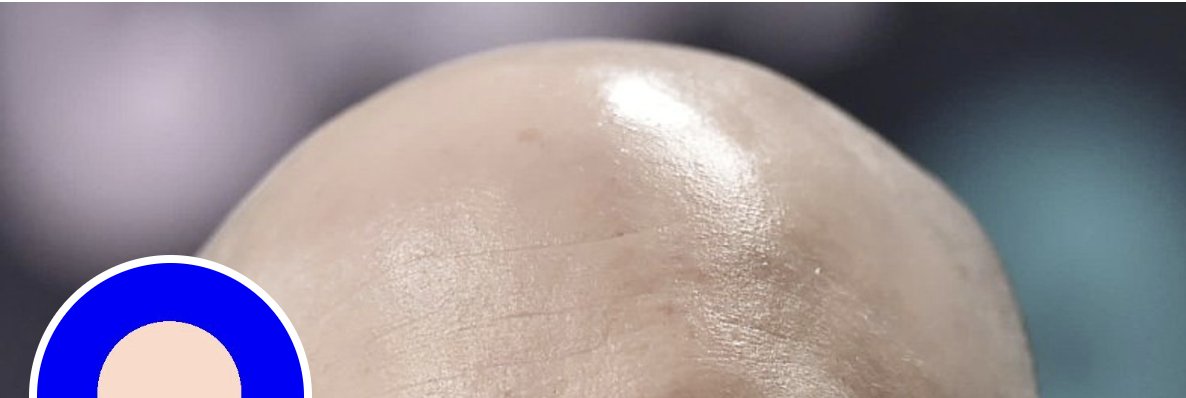 We've listed the BALD/ETH pair on YumYumSwap! 🎉 Trade or provide concentrated liquidity for this pair, and you'll be eligible for the Trading or Liquidity YUM YUM airdrop! Don't miss out on this opportunity. <a href="/BaldBaseBald/">Bald</a> 

Join now: info.yumyumswap.com/#/base-mainnet…

#YumYumSwap #BALD