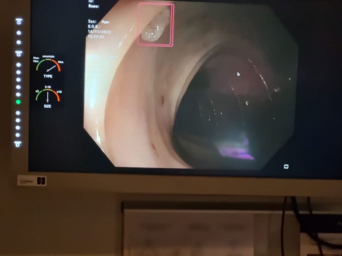 MedTechNow_'s tweet photo. #regulatory #news 

~@Axial_3D receives clearance for Axial3D INSIGHT™ #MedicalImage segmentation platform

~@Nesa_Medtech gets US FDA 510(k) for #fibroid #mapping tool

~FDA authorizes @MagentiqEye's cutting-edge #AI #gastrointestinal lesion software detection system https://t.co/VWCzh8svF6