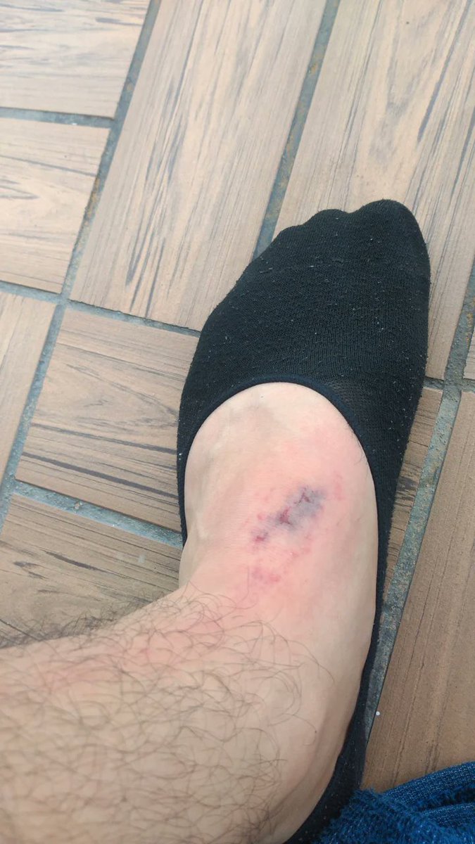 Me cayó un disco de 20 kg , no se me partió el pie  , soy un espartano alv, un poco imbécil pero espartano 😂😂