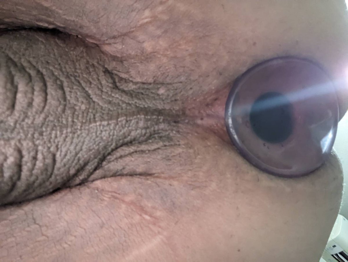 UraKerry's tweet photo. Anal plug width 7cm (2.76inch)
#gay
#anal_plug
#butt_plug https://t.co/8aERgKR1mN