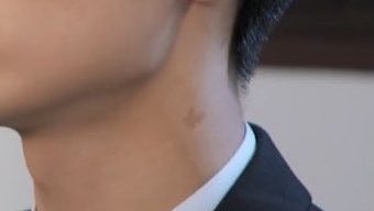 pjs_thinker's tweet photo. jay and his birthmark https://t.co/hj9QvKg4n6