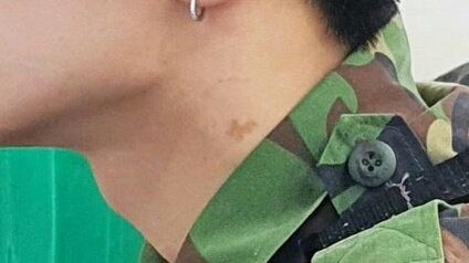 pjs_thinker's tweet photo. jay and his birthmark https://t.co/hj9QvKg4n6