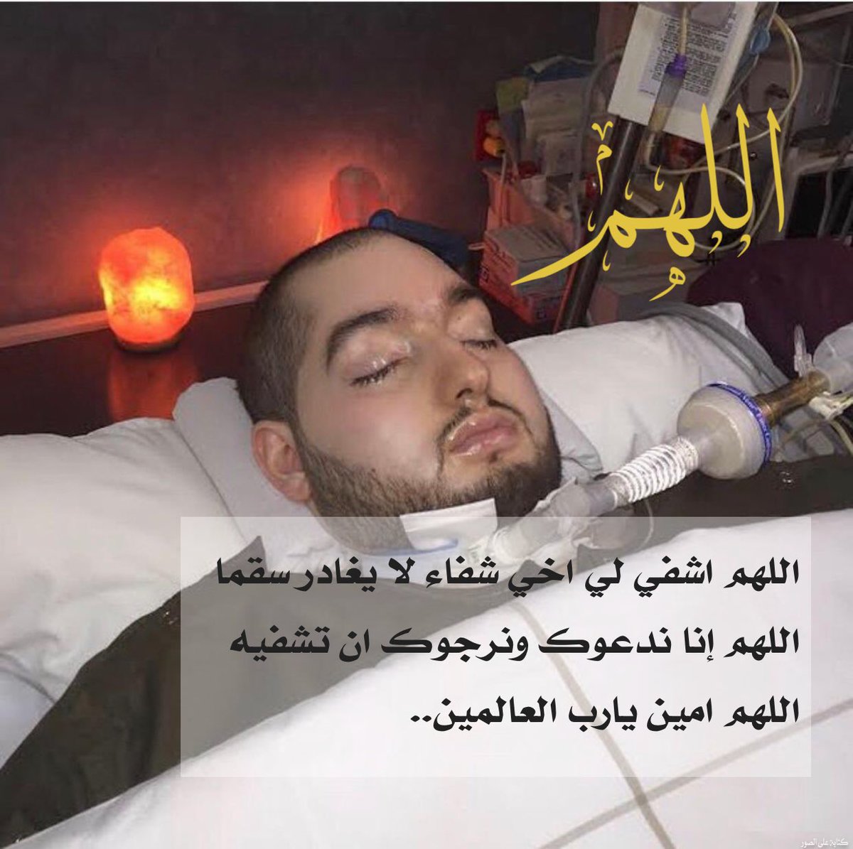 🏢مكتب الاميره لمياء الخاص @alwlydbnalsك (@sueud907111) on Twitter photo اللهم في هذا اليوم أشفي أخي أنت وحدك الشافي المعافي لا شافي إلا أنت اللهم أسكب العافيه في جسده يارب العالمين🤍 <a href="/lmyrlwlydlswd1/">مشروع الوليد الاانساني</a> اللهم في هذا اليوم أشفي أخي أنت وحدك الشافي المعافي لا شافي إلا أنت اللهم أسكب العافيه في جسده يارب العالمين🤍 <a href="/lmyrlwlydlswd1/">مشروع الوليد الاانساني</a>