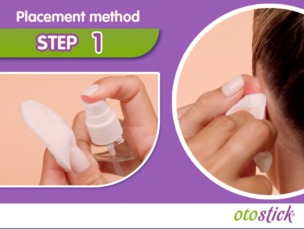 You got your first Otostick box and don't know where to start? Here is the first step to the correct placement method. 👂😉

otostick.com

#Otostick #otostickbaby #corrector #discreet #earcorrector #protrudingears #prominentears #beauty #cosmetics #aesthetics #ears