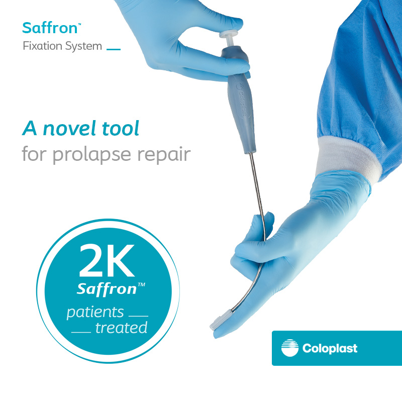 We have reached 2,000 #Saffron patients treated in less than a year since launch.
#Coloplast is committed to support you and your patients with quality products and education.
Read Saffron clinical study here: coloplast.to/Clinical-Summ
Important safety info: coloplast.to/SBS
