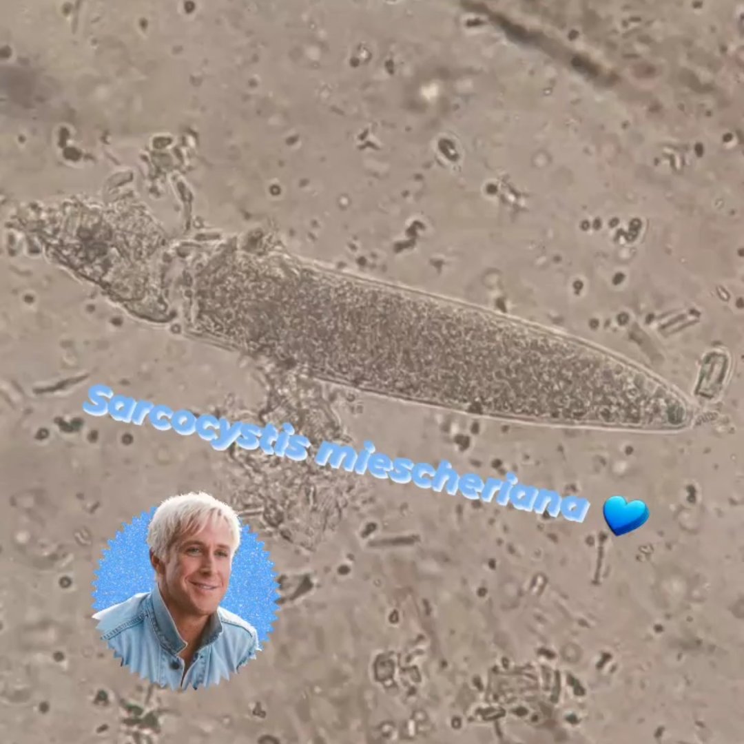 RubiolaSelene's tweet photo. She's everything. He's just Ken🔬👩‍🔬

My favourite #Barbie &amp; #Ken couple, in an unedited #foodborne #parasites edition🔎

@PostdocVoice @PhDVoice @WiParasitology #STEM #AcademicTwitter #AcademicChatter #parasitology #foodsafety #sarcocystis #suihominis #miescheriana #wildboars https://t.co/GptkXXfxlO