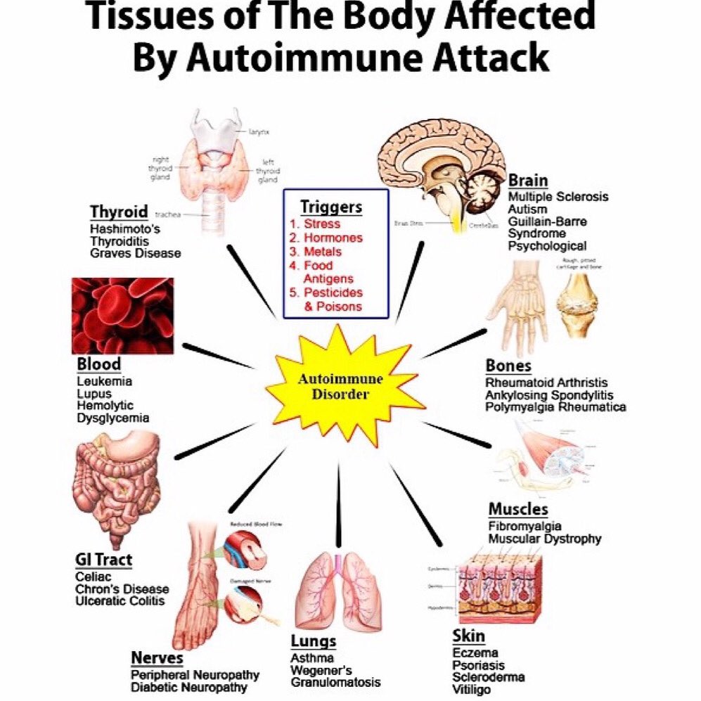 With time many people with #autoimmune conditions are getting more #foodsensitivities, reacting to more chemicals and can develop one or more #autoimmunediseases in addition to what they already have. Here’s why instagram.com/p/CvXhbq7r32j/… #thyroid #hashimotos #celiac #ra #ms