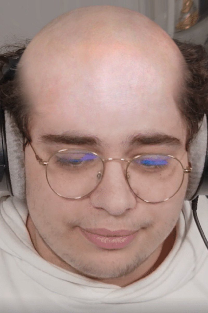 undzdeplus's tweet photo. [THREAD] JE MET LES STREAMERS CHAUVE / CALVITIE  !!!

Kameto mdrr le giga crane encore une idée et sa tête elle explose 😭 https://t.co/5xWCE24igj