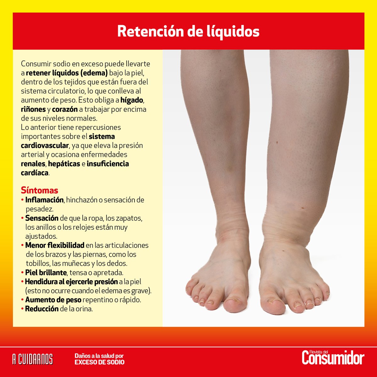 Profeco's tweet photo. 🍔🌭Una mala alimentación puede derivar en diferentes enfermedades.
🩺Por eso, en #ACuidarnos te hablamos sobre las enfermedades crónicas o situaciones que puedes padecer si consumes exceso de sodio.
✅Sigue nuestras recomendaciones y cuida tu consumo de sodio. https://t.co/vXR1zF13LF