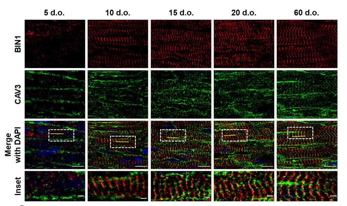 CircRes's tweet photo. Authors from the July 21st issue of @CircRes have previous work that found t-tubule growth in developing cardiomyocytes is coordinated by 3 proteins working in tandem: #BIN1, #MTM1, and #DNM2. Learn more https://t.co/Ed92YHNGal https://t.co/icW8Fa9DSr
