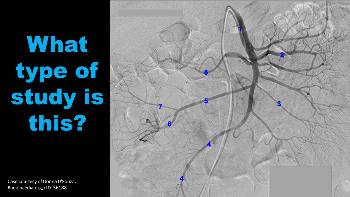 Quiz Time⏲️ Challenge yourself #MedStudentTwitter #Futureradres #MedStudentMonday

✴️Answers on the last slide✴️

Case courtesy of @DonnaDSouzaMD  rID: 36188