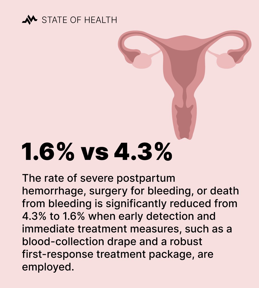 medzcool's tweet photo. The rate of severe postpartum hemorrhage, or death from bleeding is significantly reduced from 4.3% to 1.6% when early detection and immediate treatment, such as a blood-collection drape, are employed.

🎙️Listen to Episode: https://t.co/ISuafQLdAO… https://t.co/uBlHu9eqtc