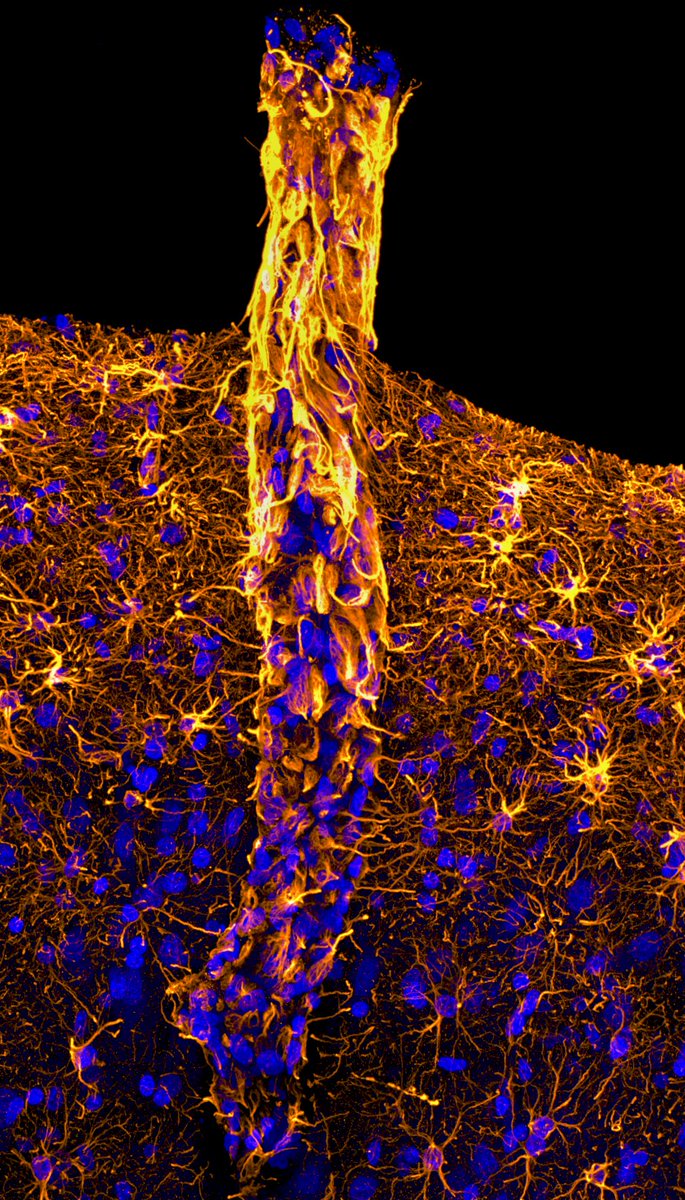 Just some astrocytes covering a blood vessel in the brain 🧠🔬! Markers:🔵Dapi, 🟡Gfap #MicroscopyMonday #sciart