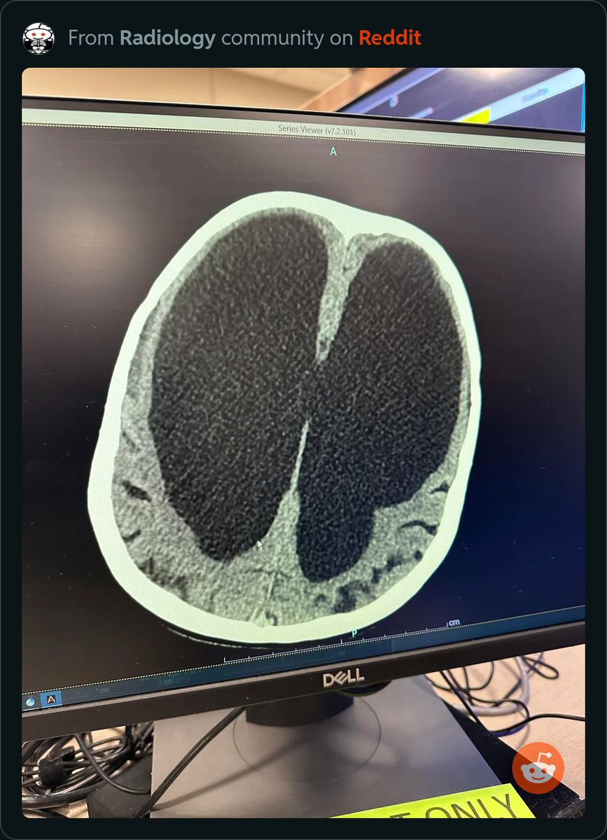 radRounds Radiology Network tweet media