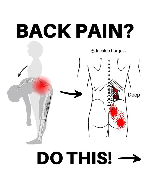 Back Pain with Bending Forward open this;