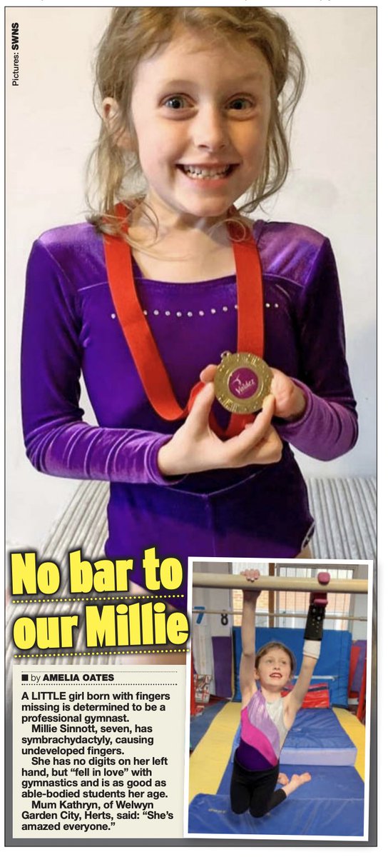 SWNSRealLife's tweet photo. EXCLUSIVE in @DailyStarSunday - Little girl born with one hand determined to become a professional gymnast - without the use of a prosthetic 🤸🏻‍♀️ 
🖋️ @ameliaeoates https://t.co/6g9SxjWd9q