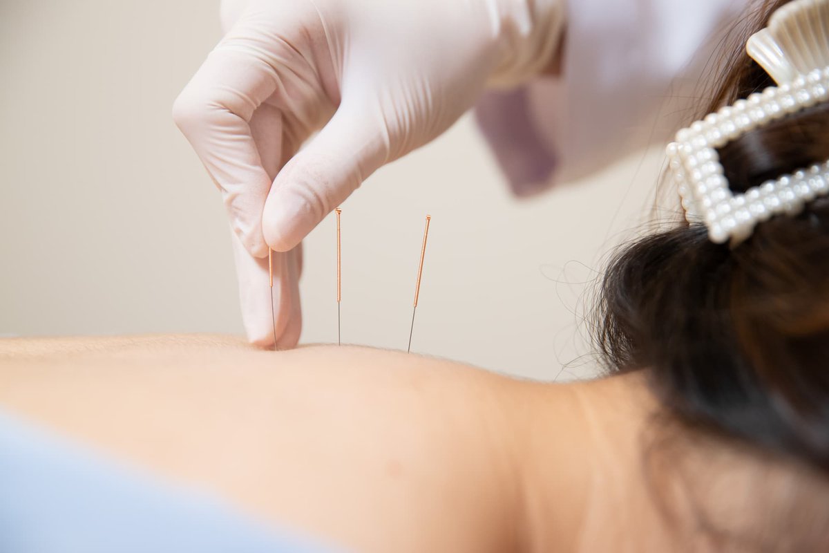 Enhancing Wellness with Chinese Medical Acupuncture in Bronte
For more, visit > tinyurl.com/yc3u2u62
@acupunctureonau
#chinesemedicalacupuncture #medicalacupuncture #acupuncture #acupunctureinnsw #acupuncturetherapy #australia