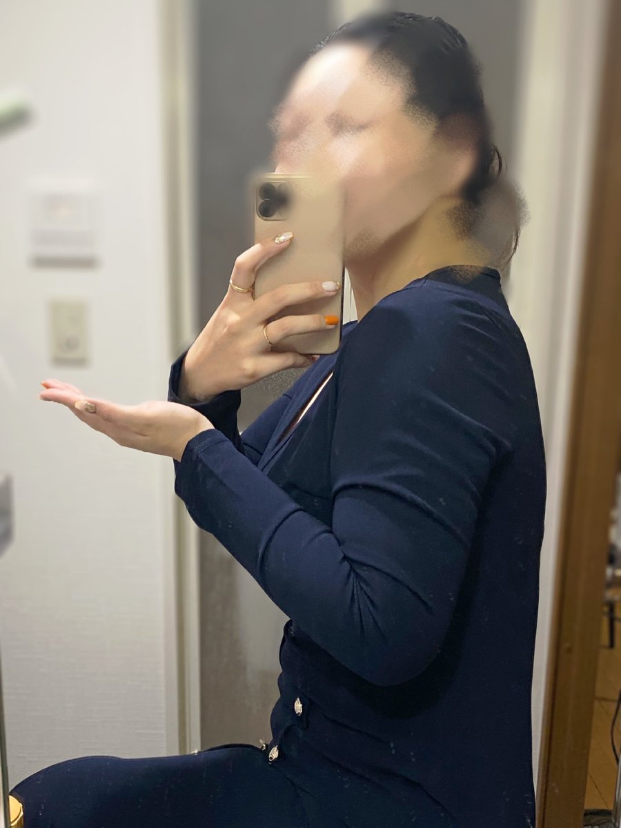 kaajimoon's tweet photo. 二の腕の脂肪吸引３ヶ月後。
少しでも分かりやすいように同じ服を着ました😊
二の腕が太過ぎて試着のジャケットが入らなかったり、パツパツで腕が上がらなかったりしてたのが無くなりました🥹笑
持っている服の袖の部分全てにゆとりができました✨
@edgeline_jpkr https://t.co/XsiguQAuk3