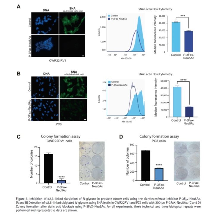 Marcin Czerwinski (@czerwinsmarcin) on Twitter photo Interesting paper about the role of ST6GAL1 in prostate cancer. ST6GAL1 is upregulated in prostata cancer tissue resulting in large branched alpha-2,6 sialylated N-glycans. Secreted ST6GAL1 as a remodeller of glycans on other cells? <a href="/MunkleyLab/">Jennifer Munkley</a> tinyurl.com/yrsm87fp
#glycotime Interesting paper about the role of ST6GAL1 in prostate cancer. ST6GAL1 is upregulated in prostata cancer tissue resulting in large branched alpha-2,6 sialylated N-glycans. Secreted ST6GAL1 as a remodeller of glycans on other cells? <a href="/MunkleyLab/">Jennifer Munkley</a> tinyurl.com/yrsm87fp
#glycotime