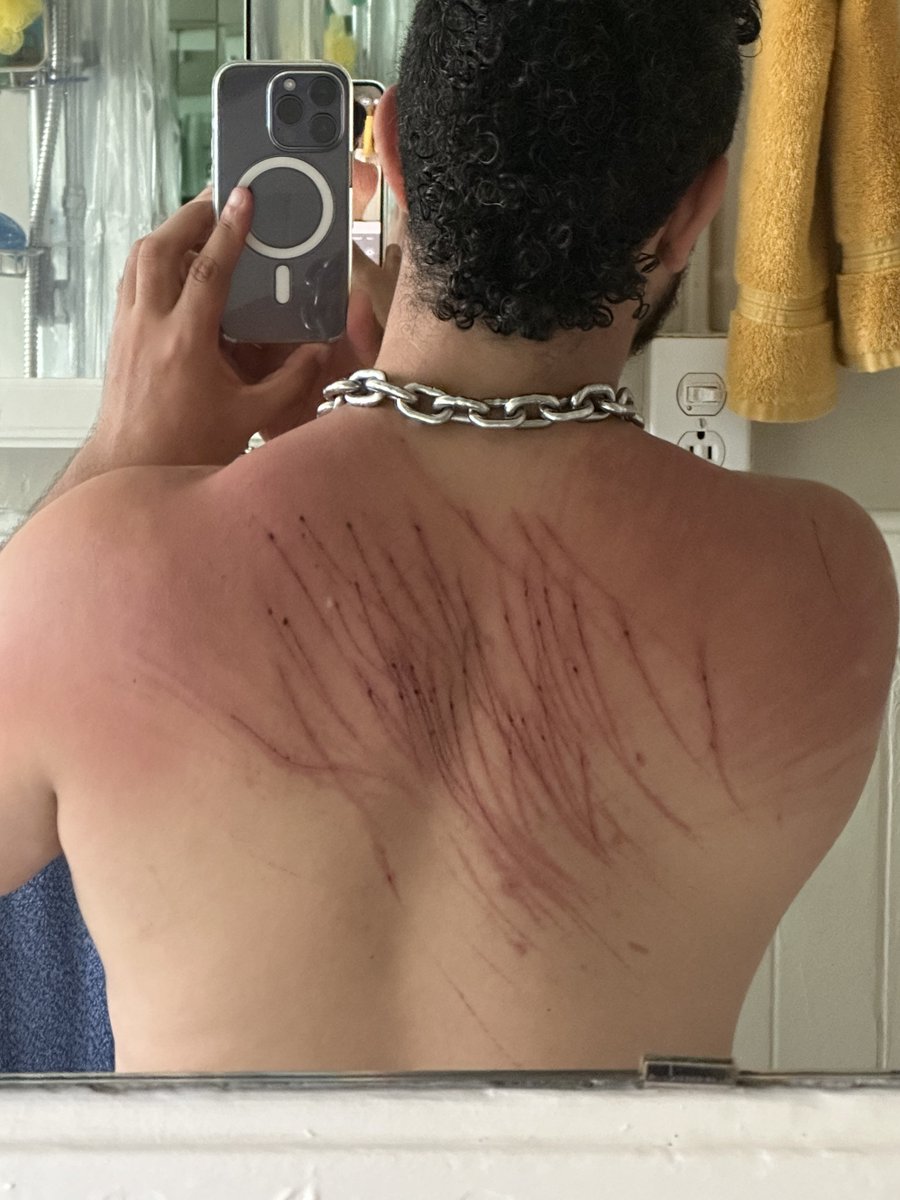 felixdapup's tweet photo. 24 hours after lashing https://t.co/BEGSQWT65a