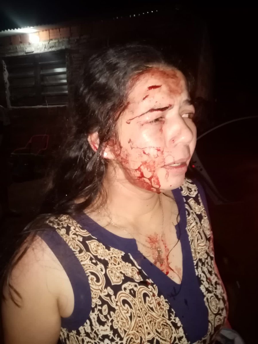 Intento de Feminicidio‼️‼️‼️

El  Concejal Municipal de  Justo Augusto Saldivar, Antonio López Moreira, en la noche del Domingo 30/07, agredió físicamente a su esposa y cuñada, Nancy Griffit.

Ambas temen por su vida.