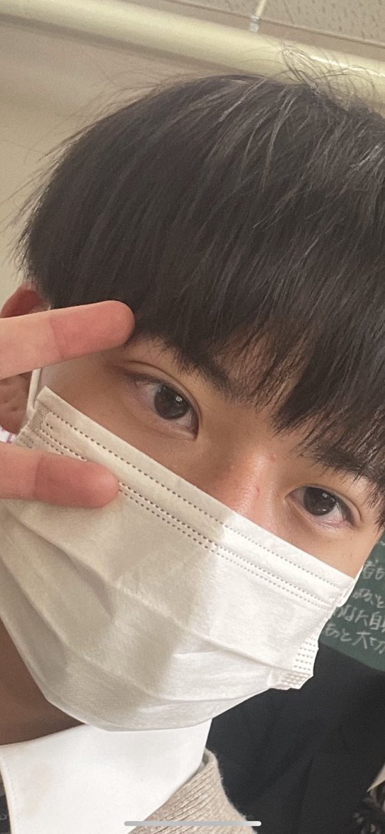 hllk__nnn's tweet photo. する前→5日後→1年半後
やっぱ二重って偉大だなって https://t.co/Zfcn5cmvYo