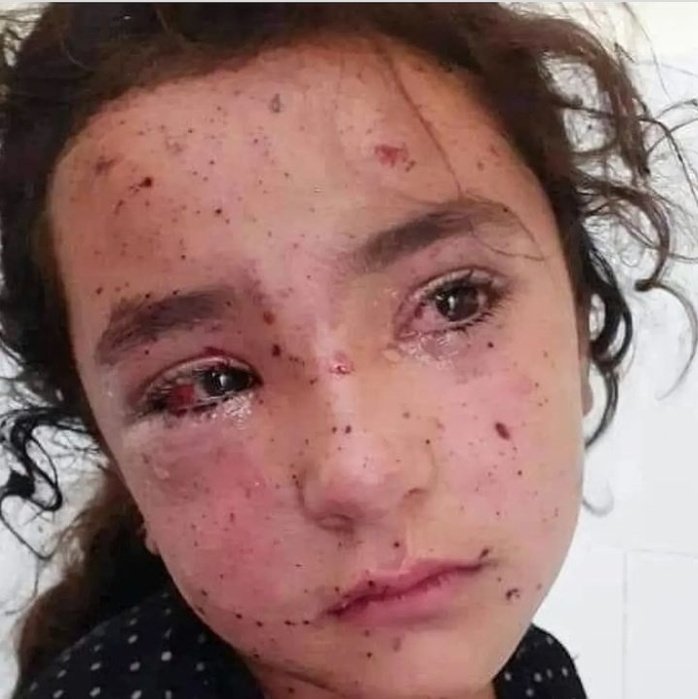 lililimillenium's tweet photo. Nem canadense, nem inglesa, nem estadunidense:
Palestina. 
Uma menina palestina.
Amarrada pelo povo "escolhido " q é financiado pelo país "democrático ".
Não gera hashtags, não gera comoção do Estadão nem da CNN. Direitos Humanos?
Ela não tem direito.
É só uma menina palestina. https://t.co/MildzMOXuP