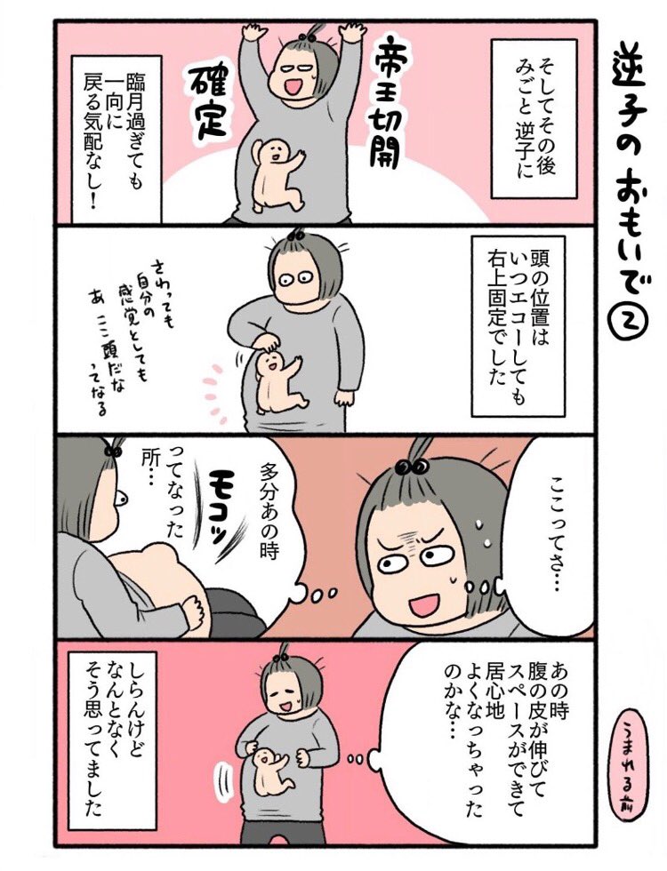 ついでに逆子のおもいで漫画✍️ じつは息子氏、逆子2世なんですよ…そんな事ある!?