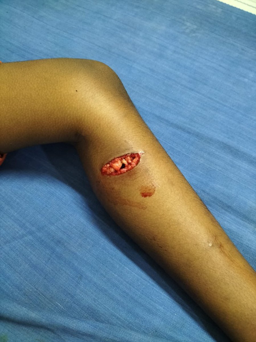 crownhussain's tweet photo. 01.08.23 Yesterday night dog bites in ramnad dist Kilakarai @keelakarai_mpl two much street dogs 🐕 roaming in day &amp; night time so pls take necessary action on this issues
Place : Kilakarai 
Ward : 19,20,21
@ramnadcollector @keelakarai_mpl @KN_NEHRU @RRajakannappan https://t.co/U5me9SPaGh