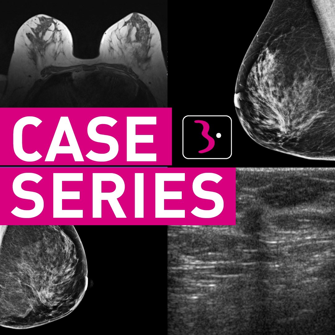 EUSOBIyc's tweet photo. Today collaborating EURORAD at 19:00 CEST #casetuesday #eusobicases #EURORAD @myESR https://t.co/7ofsHiaI2E