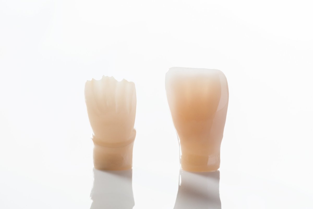 dental_direkt's tweet image. DD cube ONE® white even better!
Optimized shades with our DD Shade concept® Liquids.
👇
Call us or WhatsApp at 945-945-0606
Visit us - dentaldirektindia.com 
.
.
.
#teethcap #dentalcrown #zirconiablanks #zirconia #dentallab
#dentaldirektindia #dental #dentaldirekt