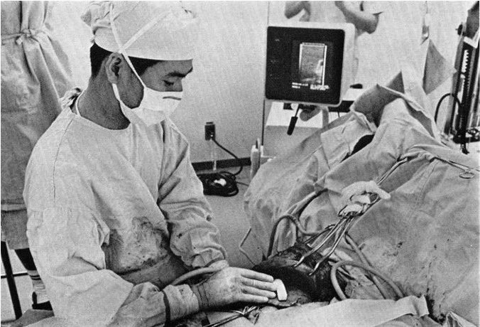 #ClassicsinSurgery Se cumplen 42 años desde la introducción de la ecografía intraoperatoria en la cirugía hepática por Masatoshi Makuuchi. Un hito para la cirugía.(foto cedida por Makuuchi)