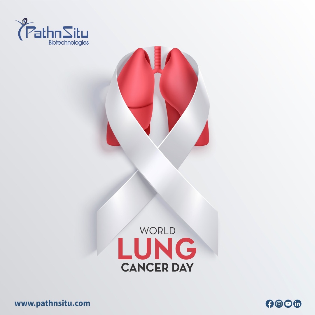 pathnsitu's tweet photo. PathnSitu is committed to raising awareness of lung cancer, encouraging and educating others to understand the importance of lung cancer and its early diagnosis.

#lungcancerawareness #earlydetection #biopsy #immunohistochemistry #histology #pathology #cancerdiagnosis https://t.co/rHvb4JjQ7Y