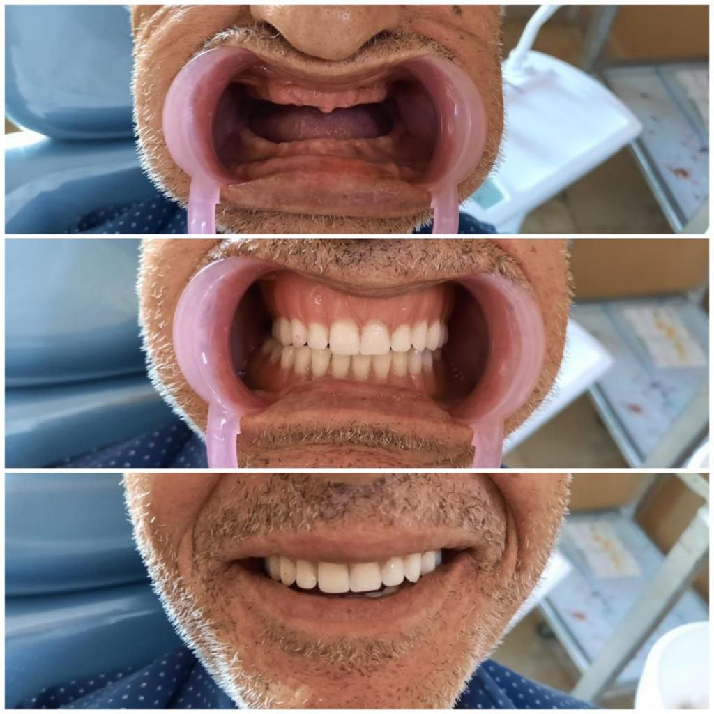 #النصر_الاتحاد_المنستيري #الشباب_الزمالك
#صباح_الخير_والسعاده #عيادة_أسنان #عروض #المزاحميه #ضرما_المزاحمية #الدفع #تمارا #تابي #ابتسامة #تويتر_بحله_جديدهx