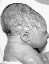 YourBabysDoctor's tweet photo. Have you ever carried a new baby and noticed a swelling on the head that looks funny, but you can't ask the parents or comment, so you keep it in your mind and keep wondering everyday why it is like that?

Well, you can ask me, I won't vex! https://t.co/trF44MXnU9