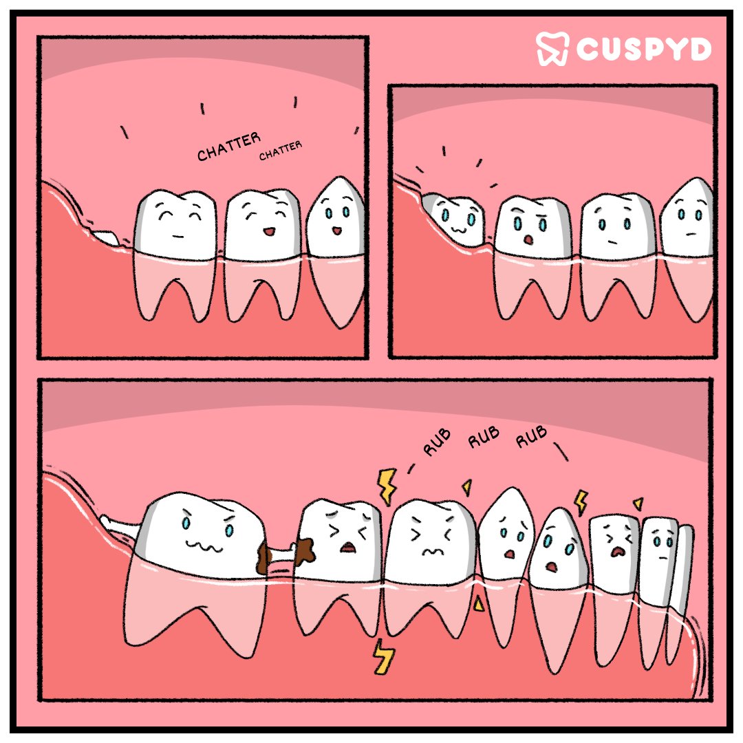 cuspyd_dental's tweet photo. Wisdom teeth erupt between the ages of 17-25years, but some of them can be impacted & cause infections, gum diseases, #tooth decay, crowding of #teeth, etc. with common symptoms such as jaw pain, swelling, earache and bad breath.
#TwitterX #cuspyd #comics #bhfyp #Trending https://t.co/aneKLHodUG